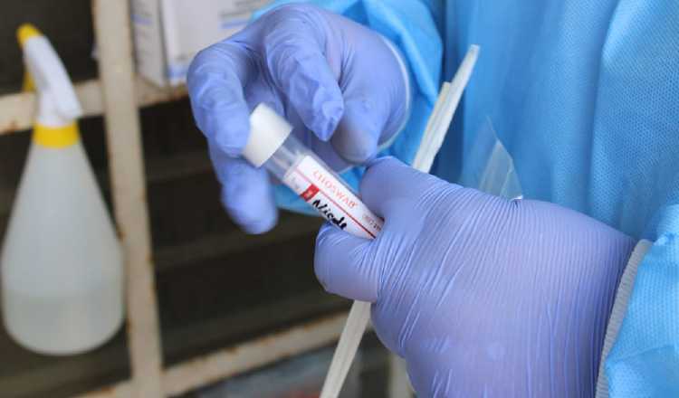 Continúan los ensayos clínicos de las vacunas contra el coronavirus. Cortesía 