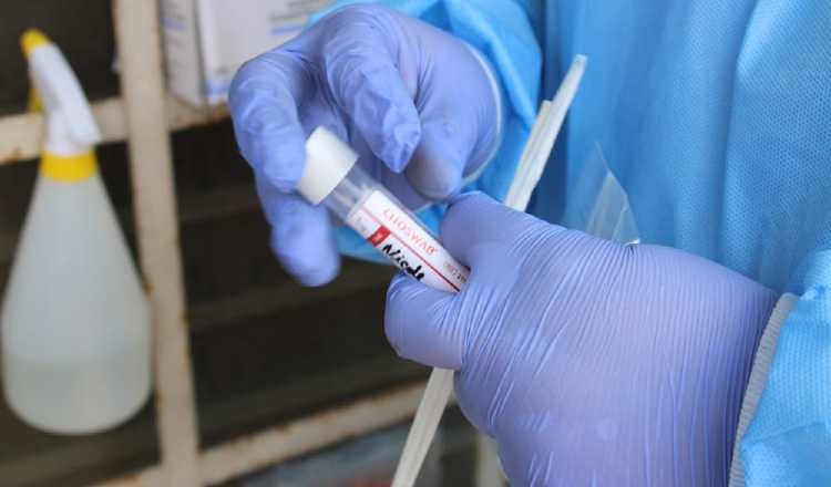 Continúan los ensayos clínicos de las vacunas contra el coronavirus. Cortesía
