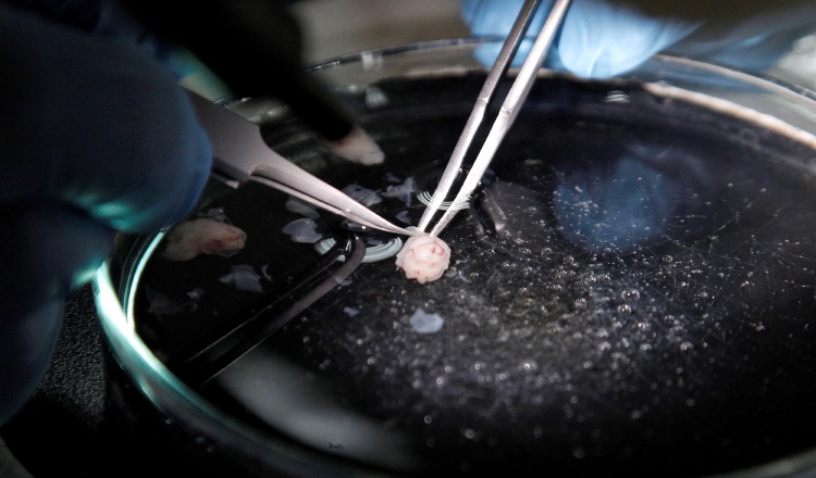 They study the dynamics of the brain to create robotic applications capable of making decisions