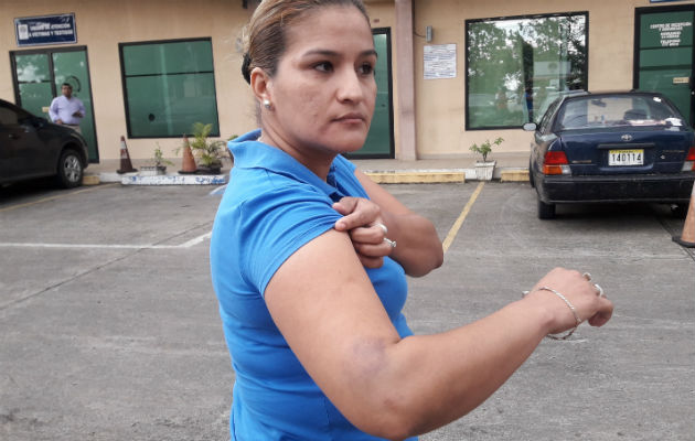 La otra mujer fue golpeada en el brazo por policías en Chiriquí. 