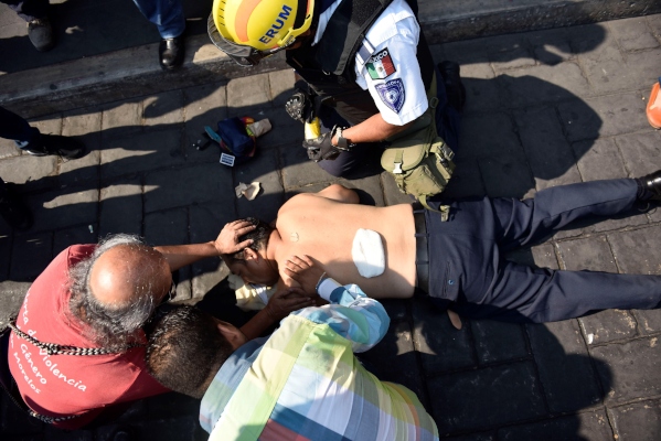 El periodista René Pérez, quien cubría la manifestación, también resultó herido de un disparo en la espalda baja. FOTO/EFE