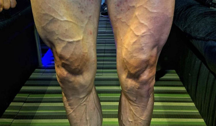 Las piernas de José Joaquín Rojas Foto @Movistar_Team