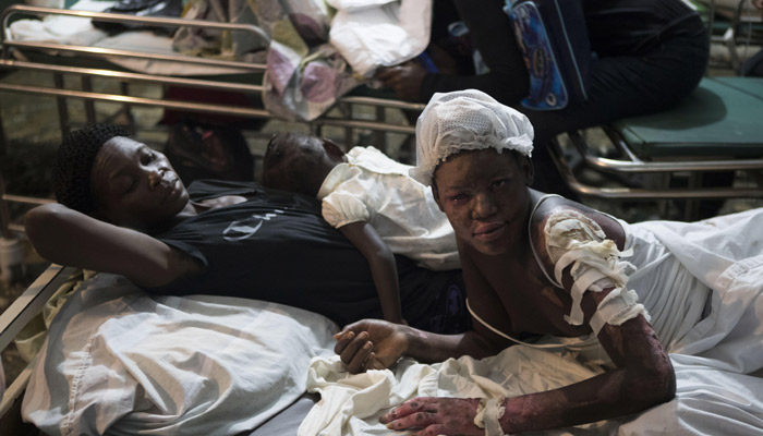 Muchos de los heridos están recibiendo atención en las afueras de este hospital, cuyo responsable de la unidad de urgencia, Rubén Pierre, reconoció en declaraciones Las limitaciones del centro para dar asistencia a los heridos. FOTO/AP