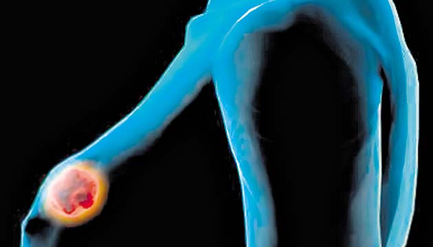 El cáncer de mama también es tratado en este centro.
