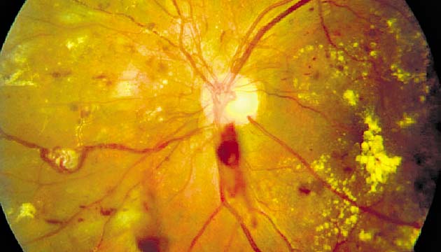 Los pacientes son atendidos por: degeneración macular, cataratas, etc.