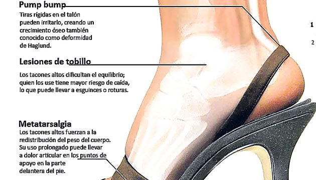 Está gráfica muestro los efectos de los tacones.
