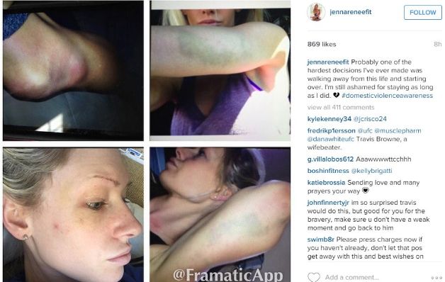 Este fue el pos con el que Jenna demostró que Browne la había agredido físicamente. / Internet Este fue el pos con el que Jenna demostró que Browne la había agredido físicamente. / Internet