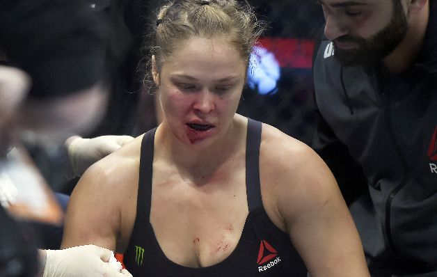 Rousey requirió sutura en los labios. Rousey requirió sutura en los labios.