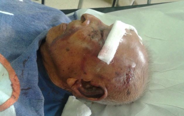 Delincuentes casi matan a señor de 91 años