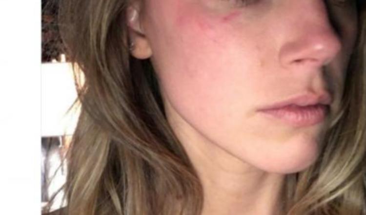 Johnny Depp la golpeó