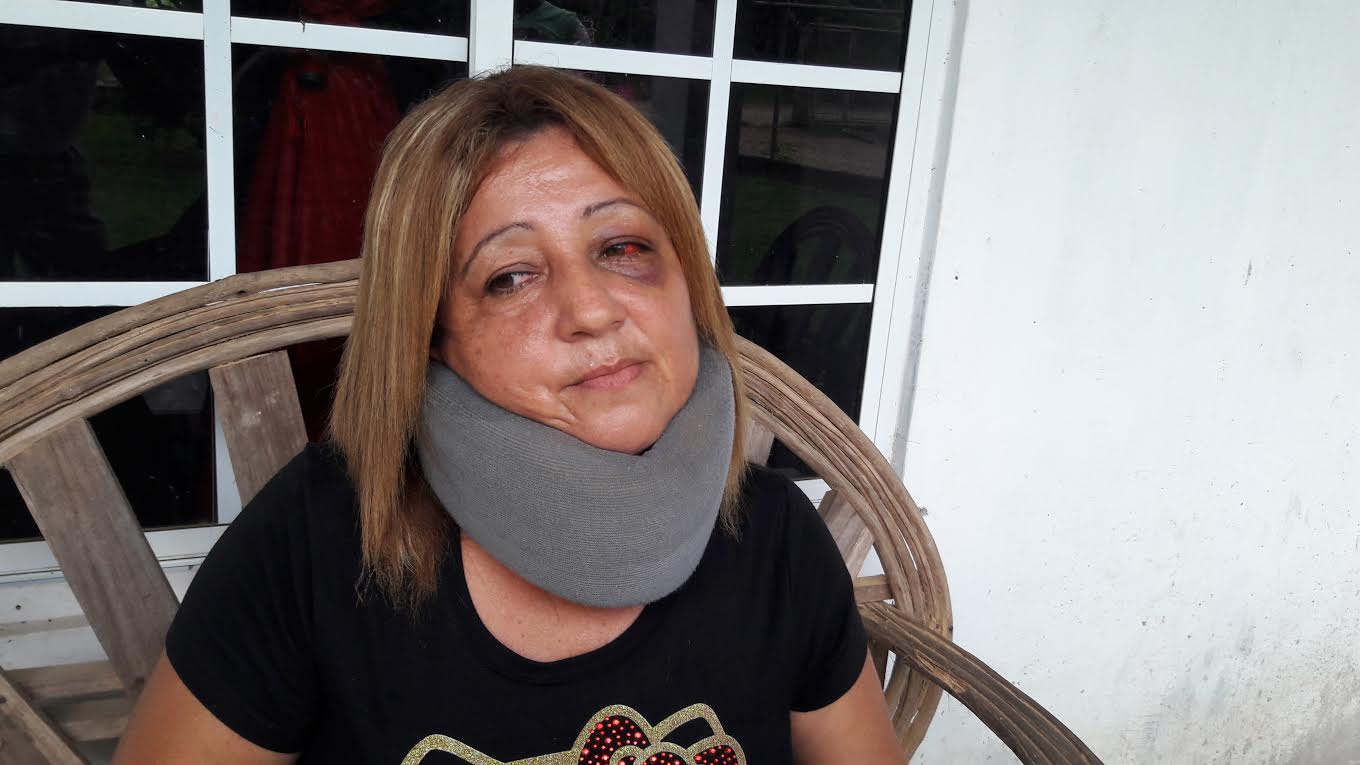 Condiciones en que quedó la educadora Karina Gómez Cortez. Foto: Melquíadez Vásquez. 