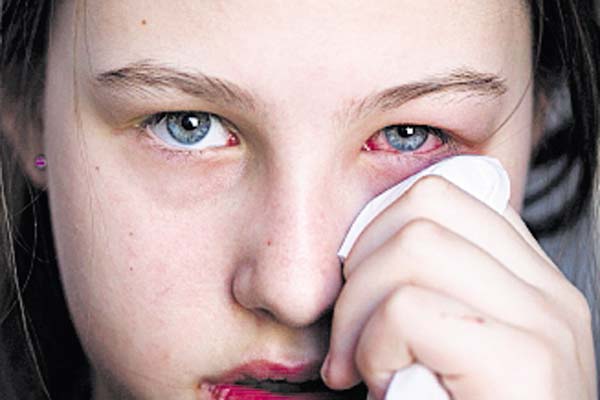 Prevención y buena comunicación son claves para combatir epidemia