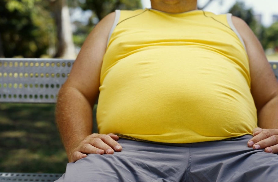 Obesidad puede aumentar incidencia de cálculos renales.