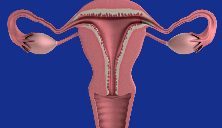 Afección del cuello uterino.