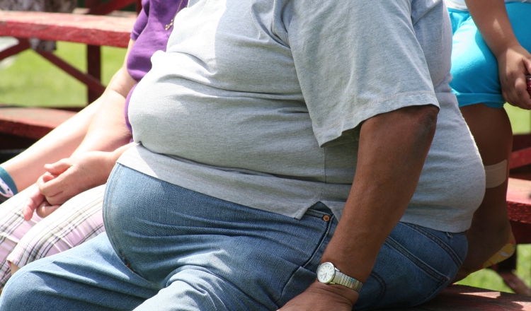 Una opción para quienes no les han funcionado la dieta y el ejercicio. 