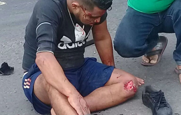 Una de las personas que resultó herida en el accidente del taxi en Buena Vista, Colón. Foto/Diómedes Sánchez 