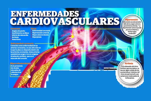 Enfermedades cardiovasculares