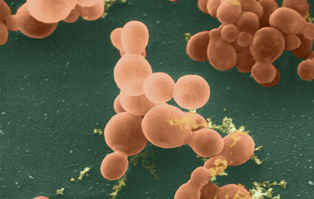 Abundaba la levadura Malassezia en pacientes con cáncer de páncreas. Foto/ Science Source.