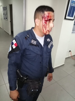 Un agente policial resultó herido al tratar de poner orden en una fiesta en Alto de Los Lagos