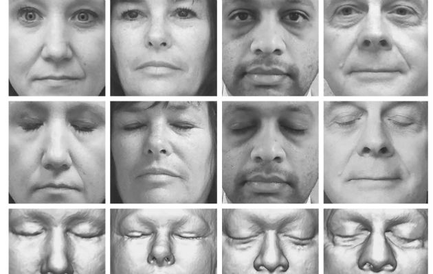 Un programa de reconocimiento facial identificó a 70 de 84 participantes en un estudio. Foto/ Mayo Clinic, via New England Journal of Medicine.