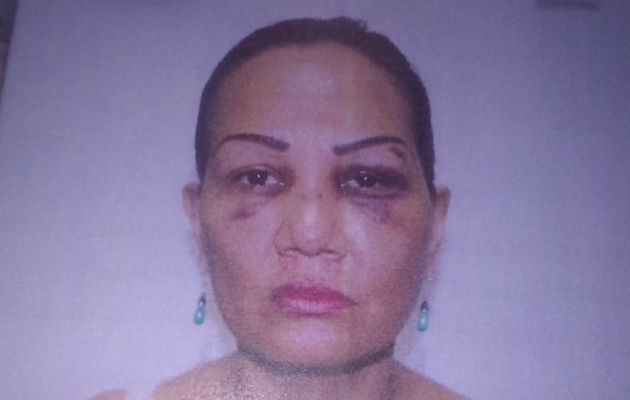 Mujer residente en Santiago asegura que de víctima la han pasado a victimaria Lorenza Batista asegura que ha sufrido maltrato por su expareja. Foto: Melquíades Vásquez.