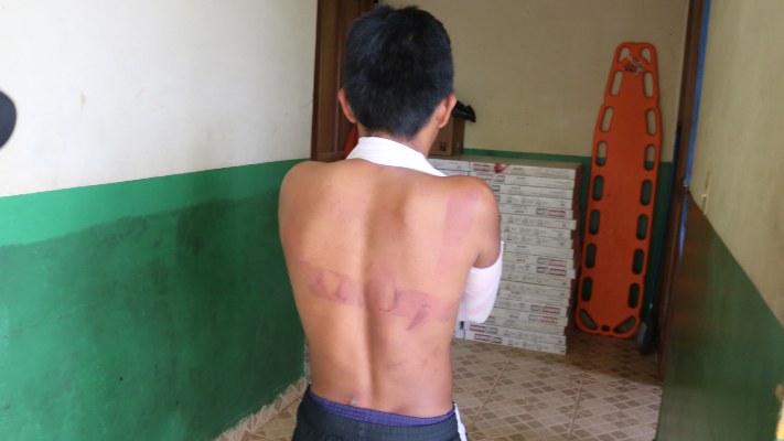 Un joven logró escapar de la iglesia y recibió ayuda médica. Foto/Melquiades Vásquez