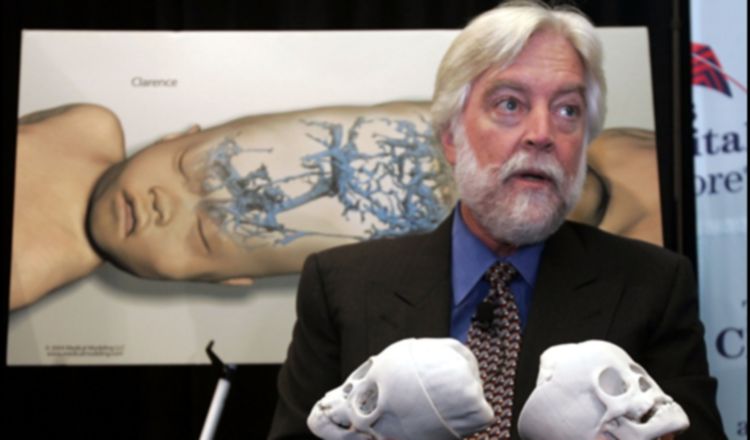 Dr. James T. Goodrich, destacado neurocirujano que realizó dos cirugías donde separó a gemelos unidos por el cerebro, falleció por complicaciones del coronavirus.