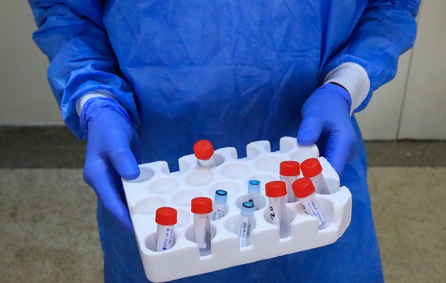 El criterio para usar las pruebas PCR ha cambiado a lo largo de la epidemia.