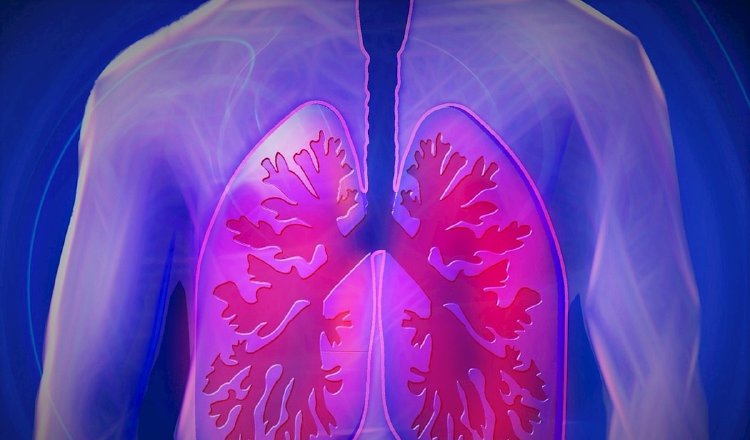 La hipertensión pulmonar es catalogada como una condición respiratoria crónica.  Pixabay