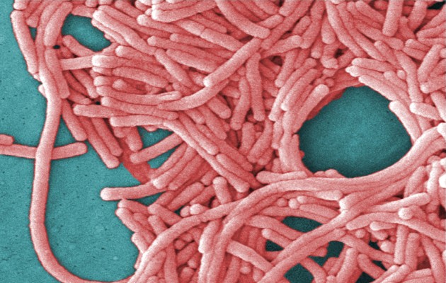 Una imagen de un microscopio electrónico de barrido coloreada de manera digital proporcionada por Janice Haney Carr/Centros para el Control y la Prevención de Enfermedades muestra la Legionella pneumophila, la bacteria que causa la enfermedad del legionario. (Janice Haney Carr/Centros para el Control y la Prevención de Enfermedades vía The New York Times). Una imagen de un microscopio electrónico de barrido coloreada de manera digital proporcionada por Janice Haney Carr/Centros para el Control y la Prevención de Enfermedades muestra la Legionella pneumophila, la bacteria que causa la enfermedad del legionario. (Janice Haney Carr/Centros para el Control y la Prevención de Enfermedades vía The New York Times).