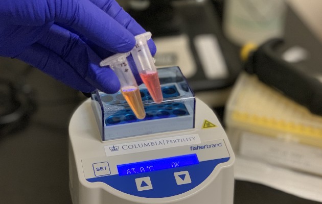 En el laboratorio de Zev Williams, los investigadores están desarrollando una prueba con saliva que arrojará resultados claros en unos 30 minutos. Foto / Dr. Zev Williams/Universidad de Columbia.