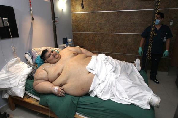 Juan Pedro Franco, pesa ahora, después de tres cirugías y un largo proceso de más de tres años, entre 200 y 210 kilos, 70 de los cuales pertenecen a piel sobrante que le será retirada, y contrajo el coronavirus con sus enfermedades comórbidas