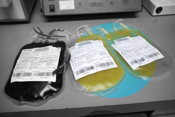 El plasma convaleciente es la parte líquida de la sangre que se recolecta de los pacientes que se han recuperado del coronavirus.