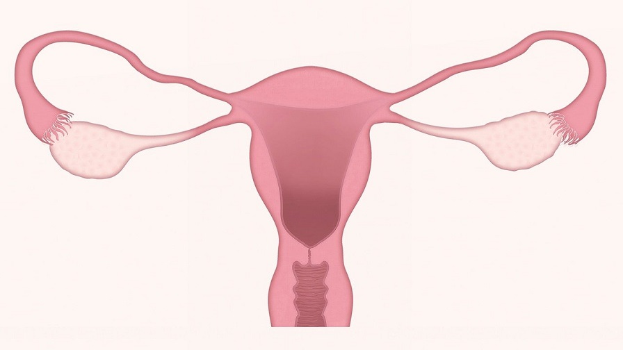 Un enemigo que pone en riesgo la fertilidad de las mujeres. Foto: Ilustrativa / Pixabay