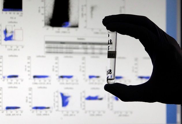 Investigadores del Hospital General Universitario de Alicante, utilizando tecnología del CSIC. Foto: EFE