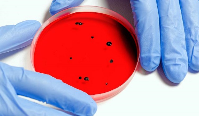 Se estudia cómo prevenir la resistencia a los antimicrobianos. Foto: Ilustrativa / Pexels