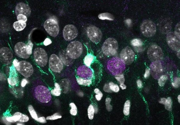 Acumulación desigual de microglía (turquesa) alrededor de las neuronas superficiales de CA1 (en violeta), rodeados por otros núcleos celulares (blanco). Foto:EFE