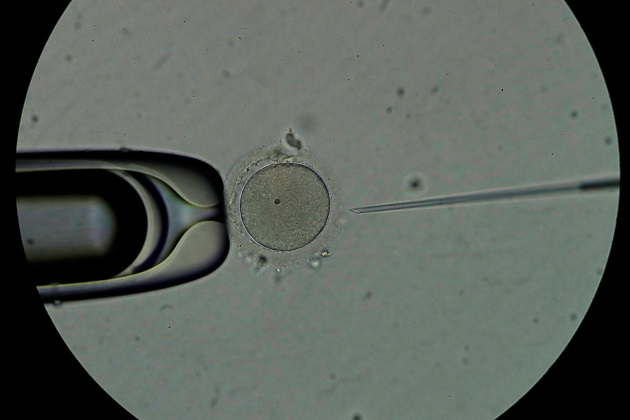 Personal técnico trabaja con espermatozoides en el laboratorio de la clínica Panama Fertility. Foto: EFE