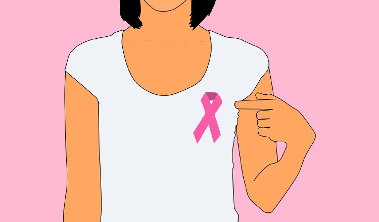 Este cáncer es el más común entre mujeres en el mundo.  Pixabay