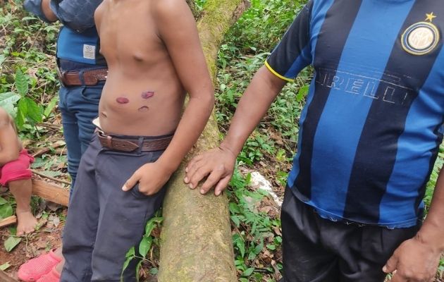Varios menores de edad resultaron heridos con balas de goma. Foto: Defensoría del Pueblo
