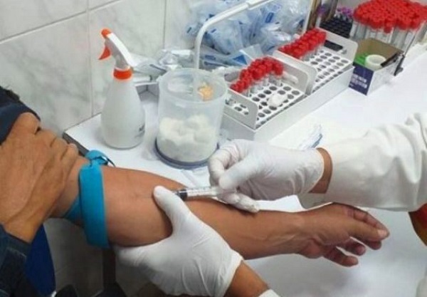 El VIH es un virus que afecta al sistema inmunológico y lo debilita permitiendo la aparición de enfermedades. Foto: Cortesía CSS