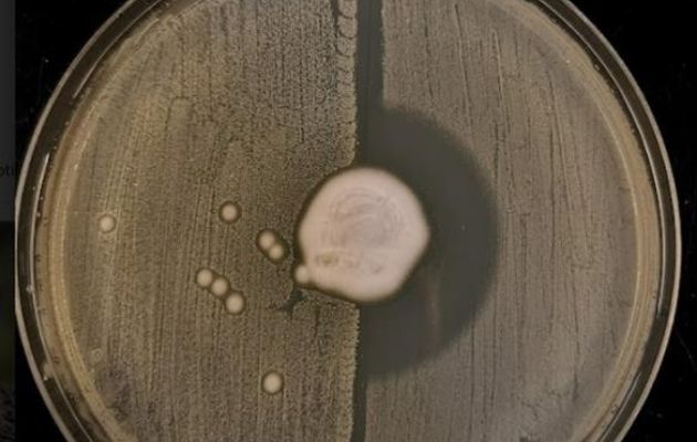 Hongo Trichophyton erinacei creciendo en el centro de una placa de agar con SARM en la mitad izquierda y la bacteria Staphylococcus aureus a la derecha. EFE