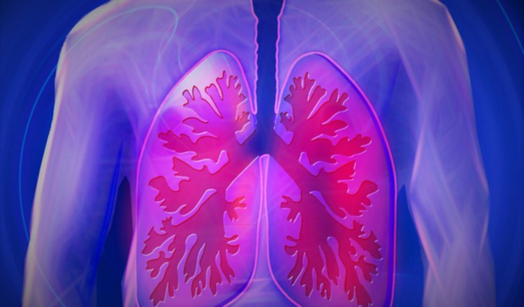 Es el segundo cáncer más frecuente en el mundo. Pixabay