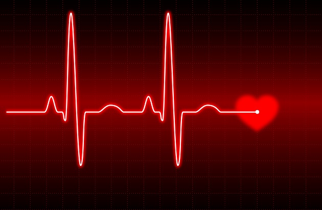 El paro cardíaco, también conocido como paro cardíaco repentino o súbito, hace que el corazón deje de latir repentinamente. 