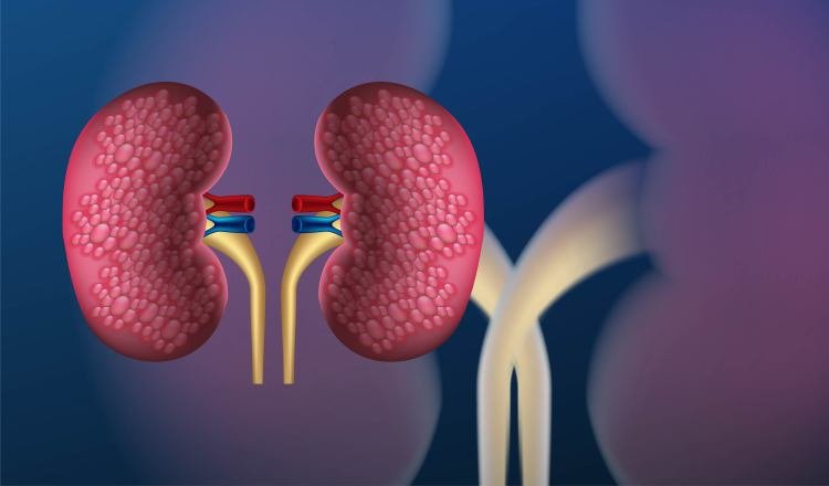 Los signos de alarma en el cáncer renal son fatiga y cansancio, dolores lumbares, pérdida de apetito y peso. Ilustrativa / Freepik
