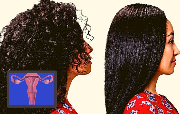 No se encontraron asociaciones entre el cáncer de útero y﻿ el uso de tintes para el cabello.