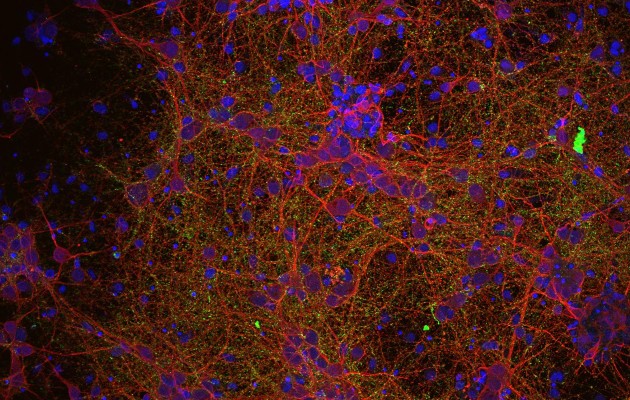 Centros de investigación de seis países europeos han lanzado un proyecto pionero en el mundo para tratar de encontrar tratamientos eficaces contra las lesiones medudales.. Foto: EFE