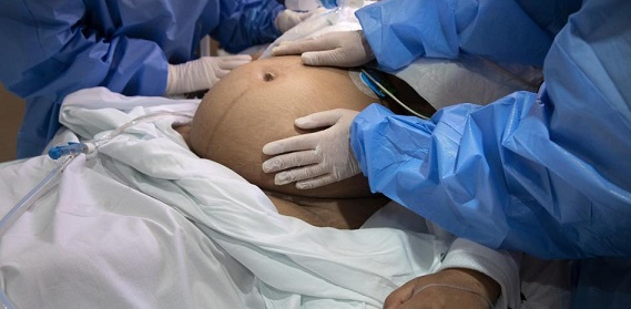 Gran parte de las mujeres embarazadas en Panamá están en sobrepeso. Archivo.