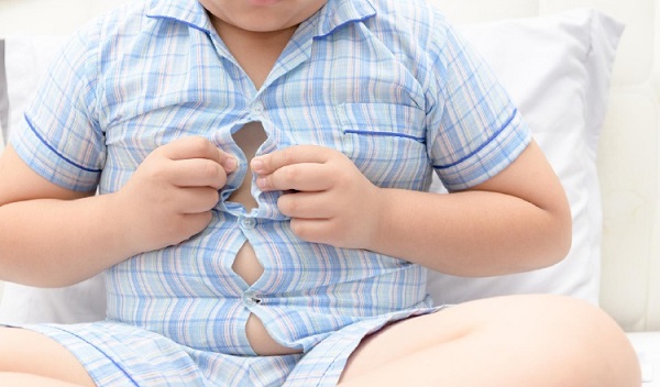  La  obesidad es una enfermedad crónica con consecuencias importantes para la salud. Foto: Ilustrativa / Pexels
