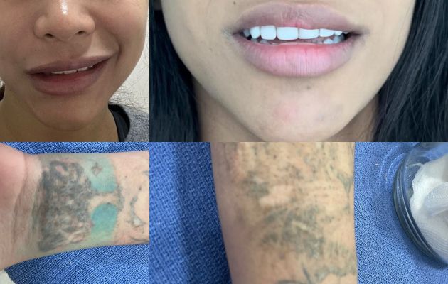 Dos víctimas de clínicas estética sin personal idóneo. Foto: Cortesía